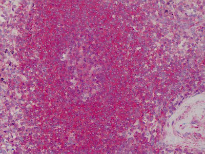 IHC - TPM1 / Tropomyosin Antibody ALS13626