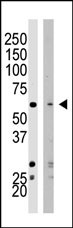 Western blot analysis of SET07 polyclonal antibody (Cat. #AP1191a) in HeLa cell lysate (Lane 1) and NIH/3T3 cell lysate (Lane 2). SET07 (arrow) was detected using purified Pab. Secondary HRP-anti-rabbit was used for signal visualization with chemiluminescence.