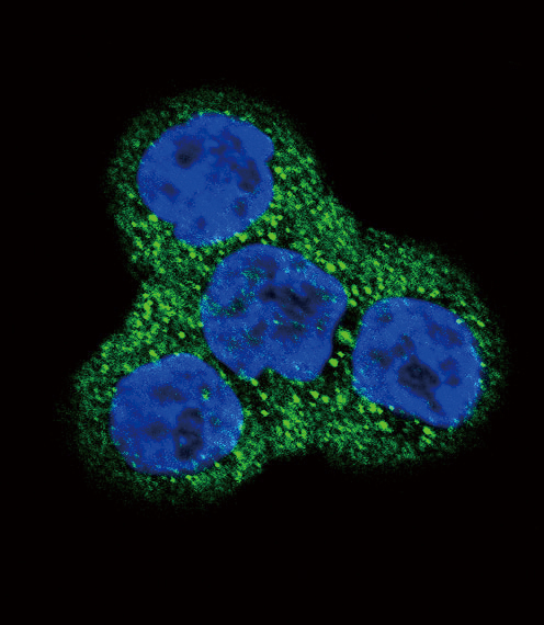 Confocal immunofluorescent analysis of PDGFRB Antibody (N-term)(Cat#AP7667a) with WiDr cell followed by Alexa Fluor 488-conjugated goat anti-rabbit lgG (green).DAPI was used to stain the cell nuclear (blue).