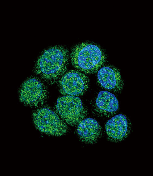 Confocal immunofluorescent analysis of BTK Antibody (Center)(Cat#AP7699c) with 293 cell followed by Alexa Fluor 488-conjugated goat anti-rabbit lgG (green).DAPI was used to stain the cell nuclear (blue).
