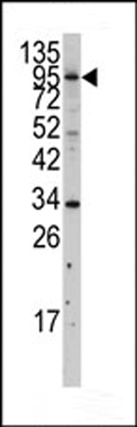Western blot analysis of anti-MYLK3 Antibody (N-term) (Cat. #AP7965a) in A375 cell line lysates (35ug/lane). MYLK3 (arrow) was detected using the purified Pab.
