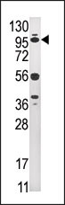 Western blot analysis of anti-USP1 Pab (Cat. #AP2130b) in HepG2 cell line lysate (35ug/lane). USP1(arrow) was detected using the purified Pab
