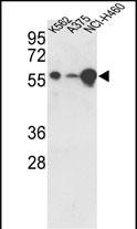 Western blot analysis of hUSP3-Y505 (Cat.#AP2132b) in K562, A375, NCI-H460 cell line lysates (35ug/lane). USP3 (arrow) was detected using the purified Pab.