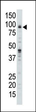The anti-USP11 Pab (Cat. #AP2139c) is used in Western blot to detect USP11 in 293 cell lysate.