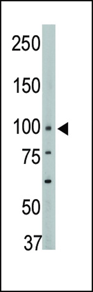 The anti-PTPH1 Center Pab (Cat. #AP8426a) is used in Western blot to detect PTPH1 in mouse brain tissue lysate.