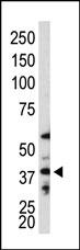Human APG3L was detected using purified polyclonal antibody AP1807c in Western blot on mouse colon tissue lysate.