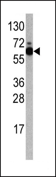 Western blot analysis of anti-RPS6KB1 Antibody (Center) Pab (Cat.#AP3289c) in Jurkat cell line lysates (35ug/lane). RPS6KB1 Antibody (Center))(arrow) was detected using the purified Pab.