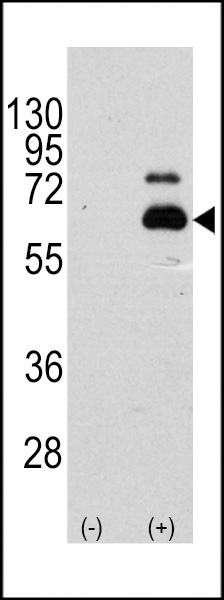 Western blot analysis of RPS6KB1 (arrow) using rabbit polyclonal RPS6KB1 Antibody (S404) (RB11396). 293 cell lysates (2 ug/lane) either nontransfected (Lane 1) or transiently transfected with the RPS6KB1 gene (Lane 2) (Origene Technologies).