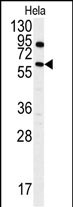 Western blot analysis of anti-ANTXR1 Antibody (Y382)(Cat.#AP7746a) in Hela cell line lysates (35ug/lane). ANTXR1 (arrow) was detected using the purified Pab.