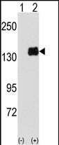 Western blot analysis of PUM1 (arrow) using PUM1 Antibody (Y83) (Cat.#AP7569d). 293 cell lysates (2 ug/lane) either nontransfected (Lane 1) or transiently transfected with the PUM1 gene (Lane 2) (Origene Technologies).