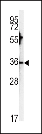 Western blot analysis of CA3 antibody (N-term)(Cat.#AP7633a) in HepG2 cell line lysates (35ug/lane). CA3 (arrow) was detected using the purified Pab.
