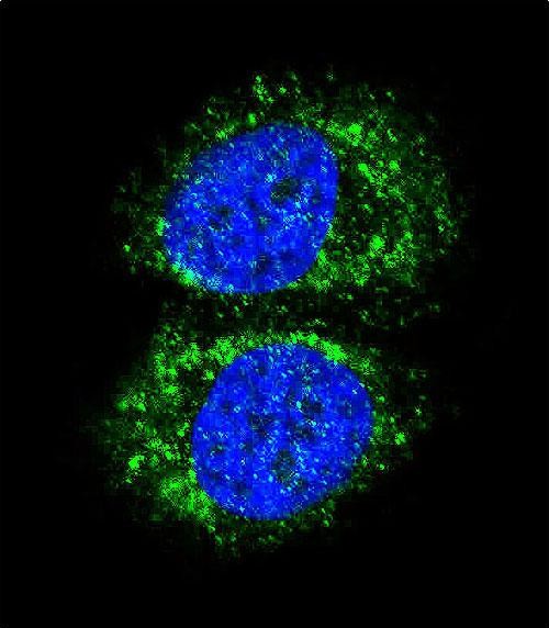 Confocal immunofluorescent analysis of RELA Antibody (N-term)(Cat#AP6826a) with MCF-7 cell followed by Alexa Fluor 488-conjugated goat anti-rabbit lgG (green).DAPI was used to stain the cell nuclear (blue).