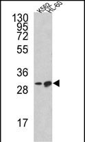 Western blot analysis of BCL2L11 Antibody (Center) (Cat. #AP8553c) in K562, HL-60 cell line lysates (35ug/lane). BCL2L11 (arrow) was detected using the purified Pab.