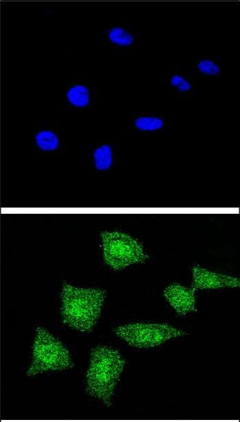 Confocal immunofluorescent analysis of SOD1 Antibody (Center) (Cat. #AP8733c) with 293 cell followed by Alexa Fluor� 488-conjugated goat anti-rabbit lgG (green).DAPI was used to stain the cell nuclear (blue).