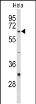 Western blot analysis of CDC20 Antibody (N-term) (Cat. #AP9138a) in Hela cell line lysates (35ug/lane). CDC20 (arrow) was detected using the purified Pab.