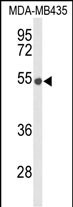 Western blot analysis of DMC1 Antibody (N-term) (Cat. #AP9329a) in MDA-MB435 cell line lysates (35ug/lane). DMC1 (arrow) was detected using the purified Pab.
