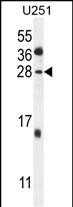 GGTLC2 Antibody (Center) (Cat. #AP10216c) western blot analysis in U251 cell line lysates (35ug/lane).This demonstrates the GGTLC2 antibody detected the GGTLC2 protein (arrow).