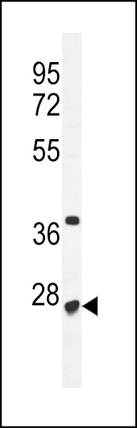 CF153 Antibody  (C-term) (Cat. #AP10785b) western blot analysis in mouse Neuro-2a cell line lysates (35ug/lane).This demonstrates the CF153 antibody detected the CF153 protein (arrow).