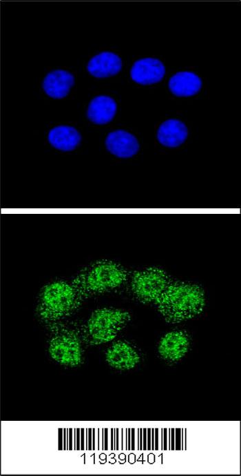Confocal immunofluorescent analysis of MSH2 Antibody (Center)(Cat. #AP11570c) with Hela cell followed by Alexa Fluor� 488-conjugated goat anti-rabbit lgG (green). DAPI was used to stain the cell nuclear (blue).
