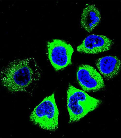 Confocal immunofluorescent analysis of YI016 Antibody (C-term)(Cat#AP11654b) with NCI-H460 cell followed by Alexa Fluor 488-conjugated goat anti-rabbit lgG (green). DAPI was used to stain the cell nuclear (blue).