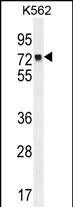 MLH1 Antibody (Center) (Cat. #AP11686c) western blot analysis in K562 cell line lysates (35ug/lane).This demonstrates the MLH1 antibody detected the MLH1 protein (arrow).