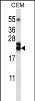 TNFSF4 Antibody (Center) (Cat. #AP12286c) western blot analysis in CEM cell line lysates (35ug/lane).This demonstrates the TNFSF4 antibody detected the TNFSF4 protein (arrow).