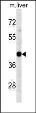 HLA-A Antibody western blot analysis in mouse Liver tissue lysates (35?g/lane).This demonstrates the HLA-A antibody detected the HLA-A protein (arrow).
