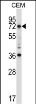RORC Antibody (Center) (Cat. #AP13786c) western blot analysis in CEM cell line lysates (35ug/lane).This demonstrates the RORC antibody detected the RORC protein (arrow).