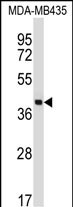 SFTPD Antibody (C-term) (Cat. #AP13998b) western blot analysis in MDA-MB435 cell line lysates (35ug/lane).This demonstrates the SFTPD antibody detected the SFTPD protein (arrow).