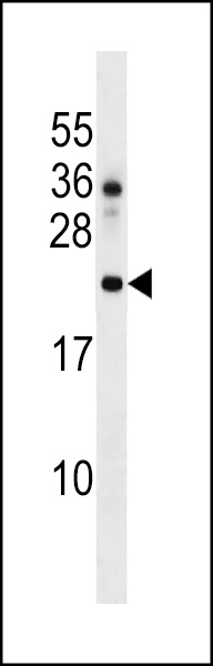 DNAJC24 Antibody (Center) (Cat. #AP16208c) western blot analysis in HL-60 cell line lysates (35ug/lane).This demonstrates the DNAJC24 antibody detected the DNAJC24 protein (arrow).
