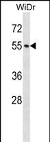 NUP50 Antibody (Center) (Cat. #AP16725c) western blot analysis in WiDr cell line lysates (35ug/lane).This demonstrates the NUP50 antibody detected the NUP50 protein (arrow).