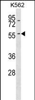 WB - KRT6A Antibody (N-term) AP16974a