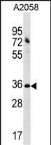 ACBD6 Antibody (N-term) (Cat. #AP18623a) western blot analysis in A2058 cell line lysates (35ug/lane).This demonstrates the ACBD6 antibody detected the ACBD6 protein (arrow).