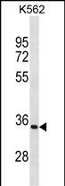 WB - PRTN3 Antibody(C-term) AP19803B