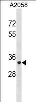 ACP5 Antibody (N-term) (Cat. #AP20031a) western blot analysis in A2058 cell line lysates (35ug/lane).This demonstrates the ACP5 antibody detected the ACP5 protein (arrow).