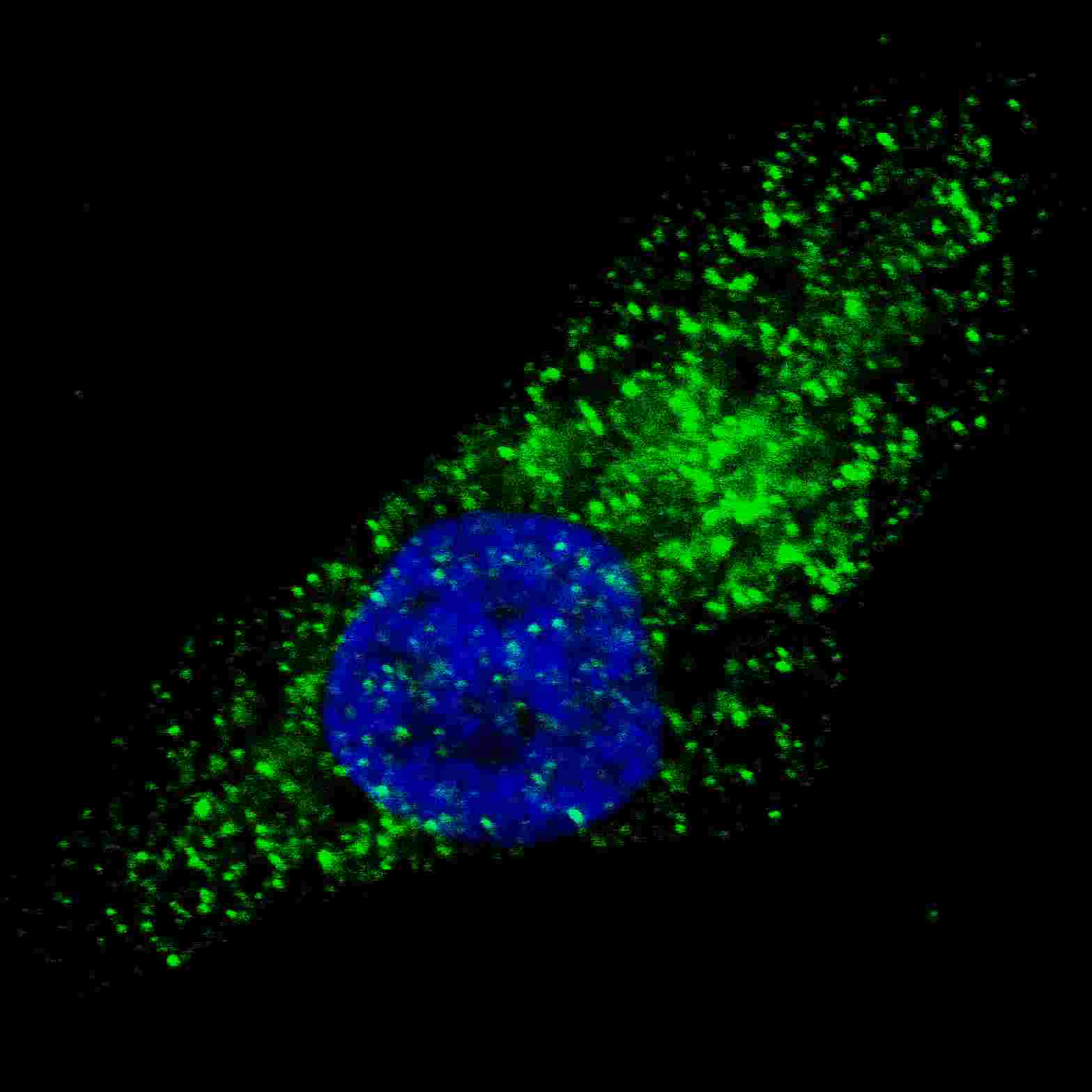 Fluorescent image of U251 cells stained with ATG9A (C-term) antibody. U251 cells were treated with Chloroquine (50 ?M,16h), then fixed with 4% PFA (20 min), permeabilized with Triton X-100 (0.2%, 30 min). Cells were then incubated with AP1814c ATG9A (C-term) primary antibody (1:100, 2 h at room temperature). For secondary antibody, Alexa Fluor� 488 conjugated donkey anti-rabbit antibody (green) was used (1:1000, 1h). Nuclei were counterstained with Hoechst 33342 (blue) (10 ?g/ml, 5 min). ATG9A immunoreactivity is localized to autophagic vacuoles in the cytoplasm of U251 cells. 