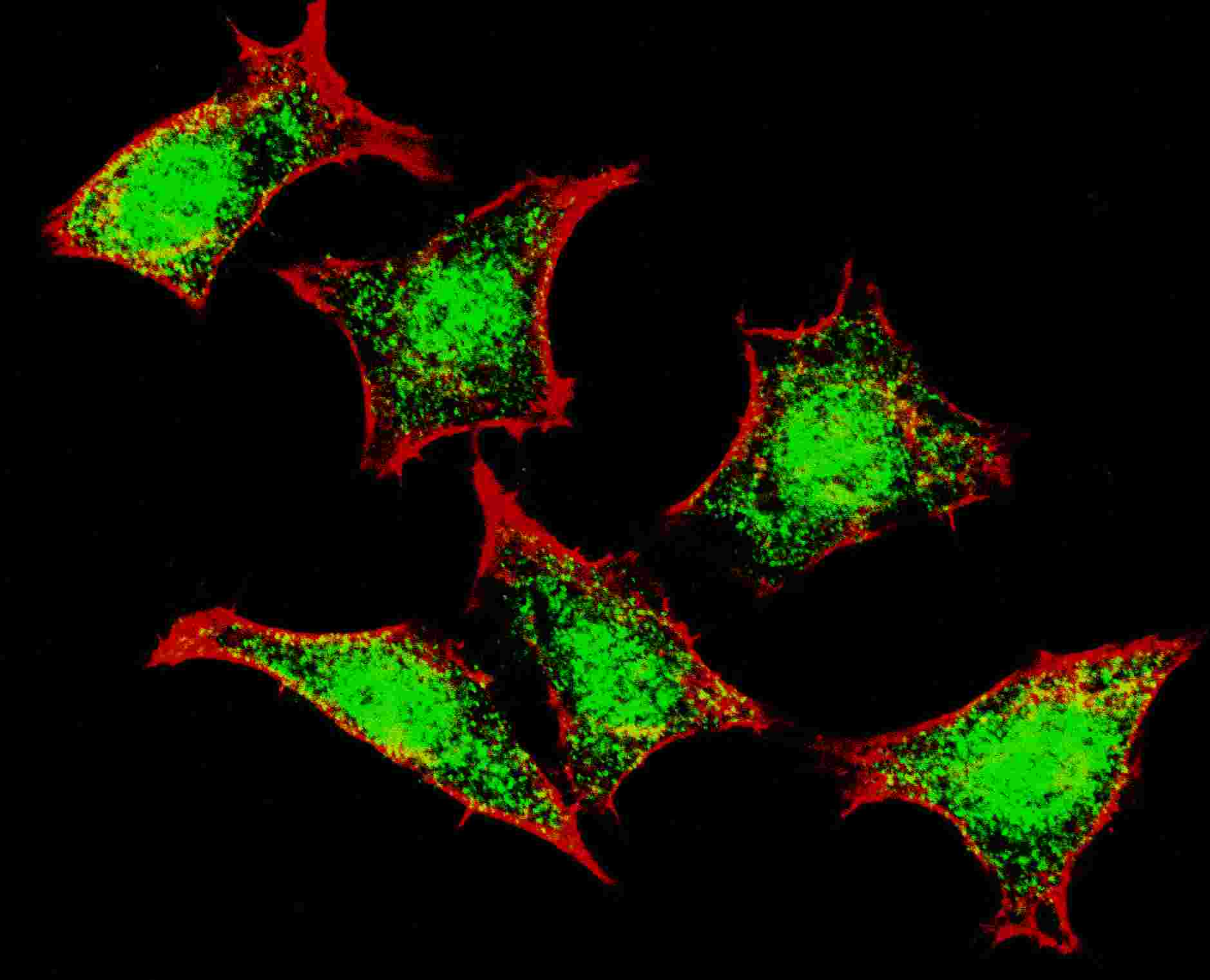 Fluorescent confocal image of HeLa cells stained with Natriuretic Peptide Receptor C (N-term) antibody. HeLa cells were fixed with 4% PFA (20 min), permeabilized with Triton X-100 (0.2%, 30 min). Cells were then incubated with AP8113a Natriuretic Peptide Receptor C (N-term) primary antibody (1:200, 2 h at room temperature). For secondary antibody, Alexa Fluor� 488 conjugated donkey anti-rabbit antibody (green) was used (1:1000, 1h). Nuclei were counterstained with Hoechst 33342 (blue) (10 ?g/ml, 5 min). Note the highly specific localization of the Natriuretic Peptide Receptor C mainly to the mainly to the nucleus.