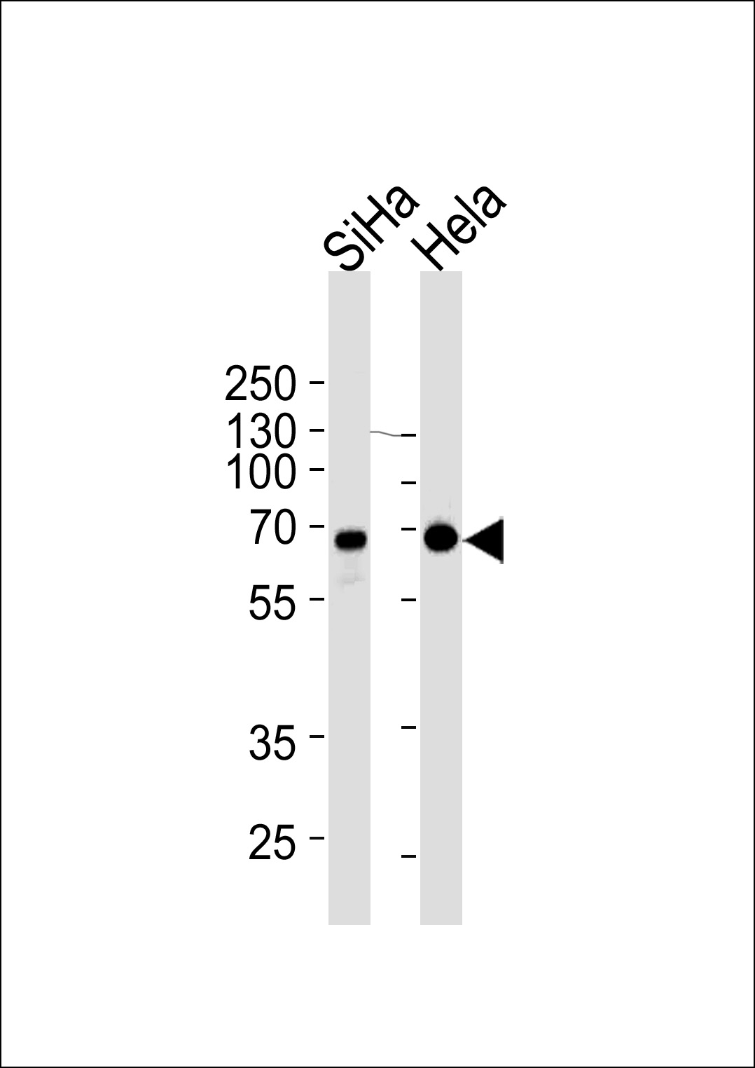 NLK Antibody(Cat. #AM2228b) western blot analysis in SiHa,Hela cell line lysates (35?g/lane).This demonstrates the NLK antibody detected the NLK protein (arrow).