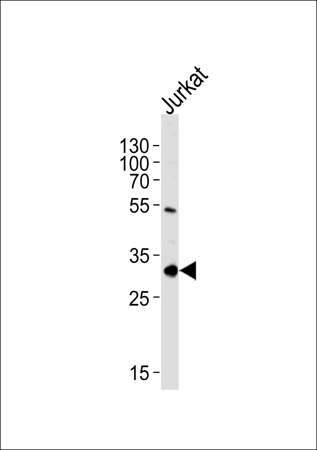 EXOSC2 Antibody(N-term) (Cat. #AP20534a) western blot analysis in Jurkat cell line lysates (35ug/lane).This demonstrates the EXOSC2 antibody detected the EXOSC2 protein (arrow).