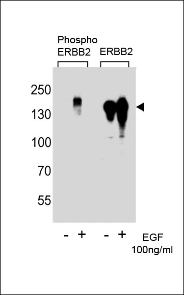 Western blot analysis of extracts from  A431 cells,untreated or treated with EGF,100ng/ml?using phospho ErbB2-Y1222 (left) or ErbB2 antibody(right)