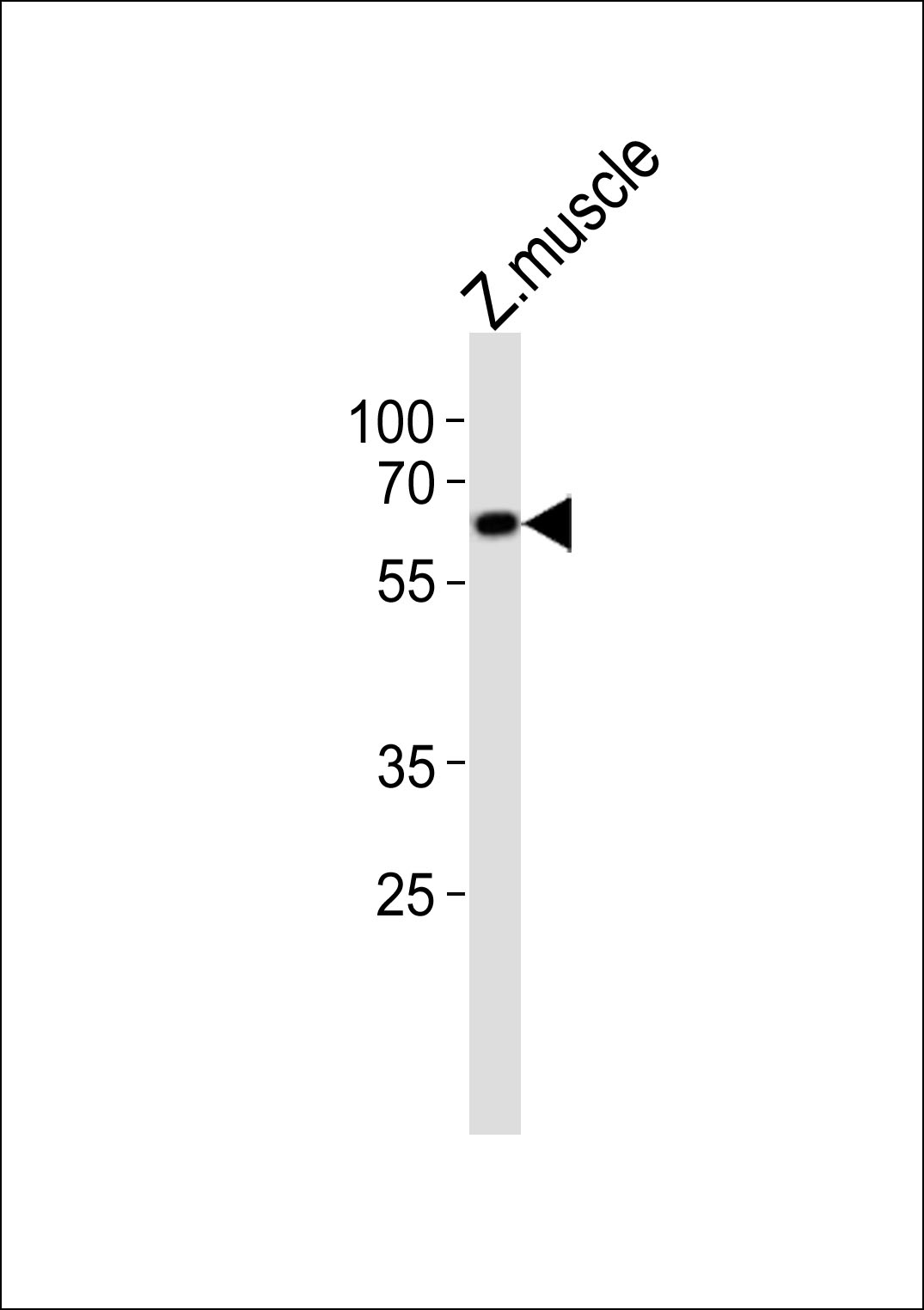 Western blot analysis of lysate from zebra fish muscle tissue lysate,  using (DANRE) edc3 Antibody (Center)(Cat.  #Azb18719a).  Azb18719a was diluted at 1:1000.  A goat anti-rabbit IgG H&L(HRP) at 1:10000 dilution was used as the secondary antibody. Lysate at 20ug.