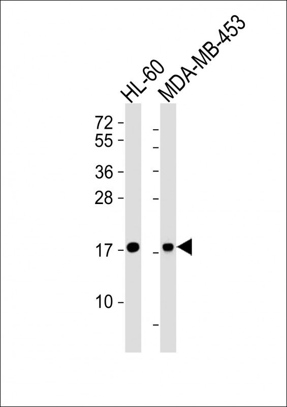 All lanes : Anti-FHIT Antibody at  1:4000 dilutionLane 1: HL-60 whole cell lysatesLane 2: MDA-MB-453 whole cell lysatesLysates/proteins at 20 ?g per lane. SecondaryGoat Anti-mouse IgG,  (H+L), Peroxidase conjugated at 1/10000 dilutionPredicted band size : 17 kDaBlocking/Dilution buffer: 5% NFDM/TBST.