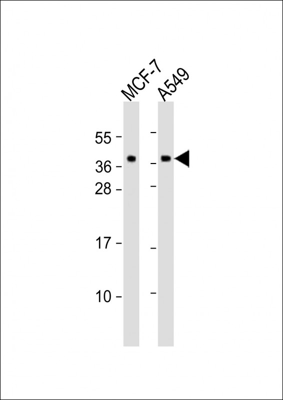 All lanes : Anti-CMA1 Antibody (N-Term) at 1:2000 dilutionLane 1: MCF-7 whole cell lysatesLane 2: A549 whole cell lysatesLysates/proteins at 20 �g per lane. SecondaryGoat Anti-Rabbit IgG,  (H+L), Peroxidase conjugated at 1/10000 dilution. Predicted band size : 27 kDaBlocking/Dilution buffer: 5% NFDM/TBST.