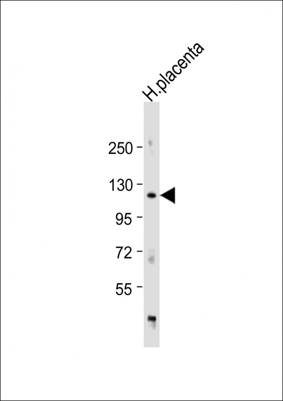 Anti-ADAM19 Antibody (Center) at 1:1000 dilution + human placenta lysateLysates/proteins at 20 �g per lane. SecondaryGoat Anti-Rabbit IgG,  (H+L), Peroxidase conjugated at 1/10000 dilution. Predicted band size : 105 kDaBlocking/Dilution buffer: 5% NFDM/TBST.