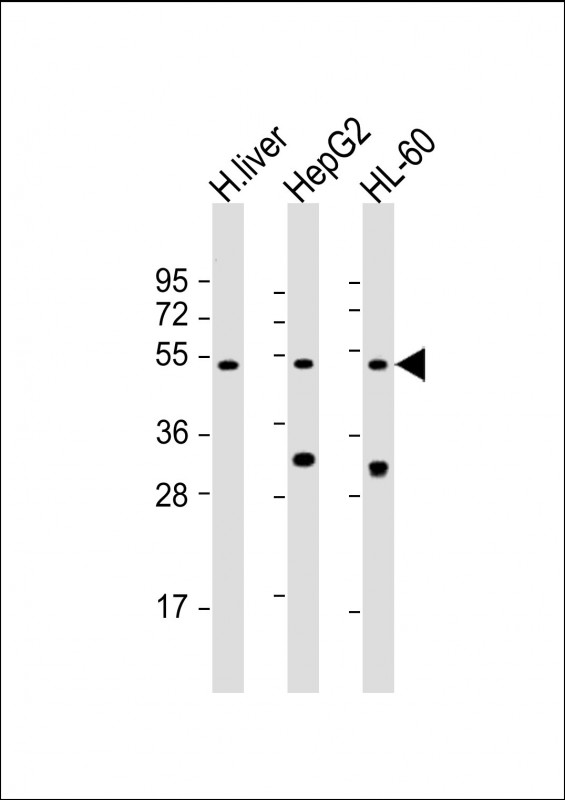 All lanes : Anti-BAAT Antibody (N-Term) at 1:2000 dilutionLane 1: human liver lysateLane 2: HepG2 whole cell lysateLane 3: HL-60 whole cell lysateLysates/proteins at 20 �g per lane. SecondaryGoat Anti-Rabbit IgG,  (H+L), Peroxidase conjugated at 1/10000 dilution. Predicted band size : 46 kDaBlocking/Dilution buffer: 5% NFDM/TBST.