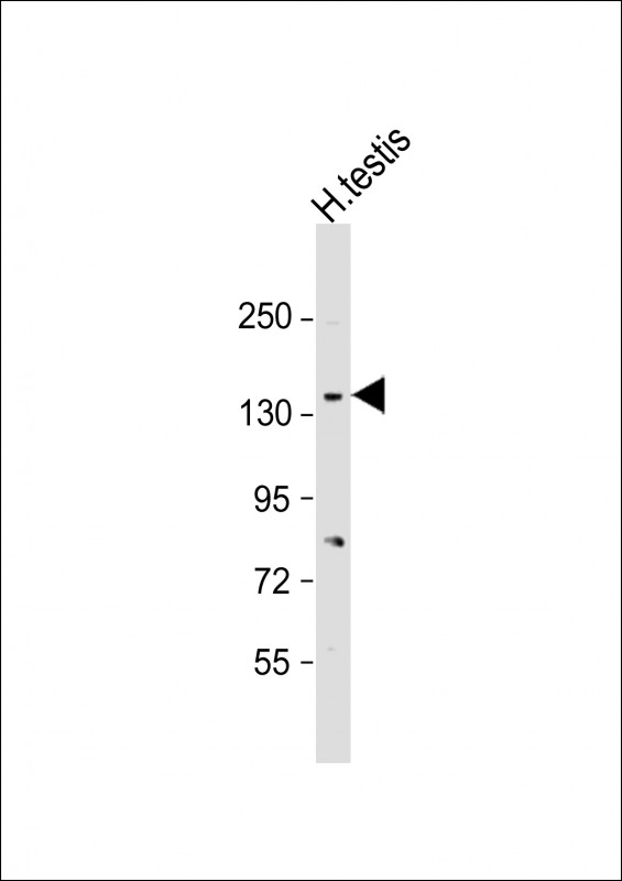 Anti-CACNA2D2 Antibody (Center) at 1:2000 dilution + human testis lysateLysates/proteins at 20 �g per lane. SecondaryGoat Anti-Rabbit IgG,  (H+L), Peroxidase conjugated at 1/10000 dilution. Predicted band size : 130 kDaBlocking/Dilution buffer: 5% NFDM/TBST.