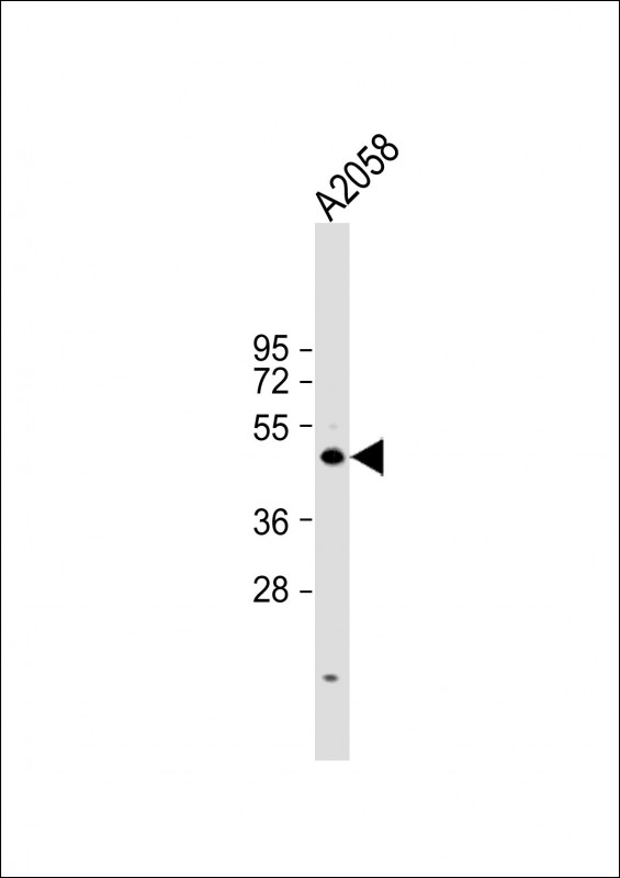 Anti-Cyclin E1 Antibody at 1:1000 dilution + A2058 whole cell lysateLysates/proteins at 20 �g per lane. SecondaryGoat Anti-Rabbit IgG,  (H+L), Peroxidase conjugated at 1/10000 dilution. Predicted band size : 47 kDaBlocking/Dilution buffer: 5% NFDM/TBST.