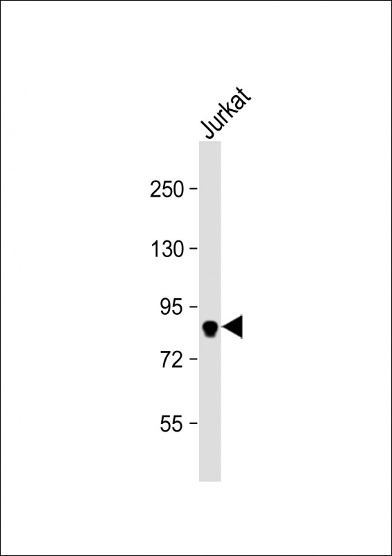 Anti-MLH1 Antibody (C-term) at 1:1000 dilution + Jurkat whole cell lysateLysates/proteins at 20 �g per lane. SecondaryGoat Anti-Rabbit IgG,  (H+L), Peroxidase conjugated at 1/10000 dilution. Predicted band size : 85 kDaBlocking/Dilution buffer: 5% NFDM/TBST.