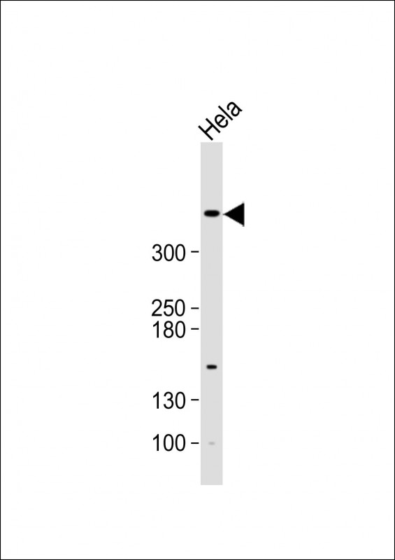 Anti-ATM Antibody (C12) at 1:500 dilution + Hela whole cell lysateLysates/proteins at 20 �g per lane. SecondaryGoat Anti-Rabbit IgG,  (H+L), Peroxidase conjugated at 1/10000 dilution. Predicted band size : 351 kDaBlocking/Dilution buffer: 5% NFDM/TBST.