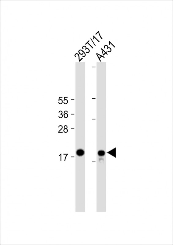 All lanes : Anti-UBE2C Antibody (C-term) at 1:2000 dilutionLane 1: 293T/17 whole cell lysateLane 2: A431 whole cell lysateLysates/proteins at 20 �g per lane. SecondaryGoat Anti-mouse IgG,  (H+L), Peroxidase conjugated at 1/10000 dilution. Predicted band size : 20 kDaBlocking/Dilution buffer: 5% NFDM/TBST.
